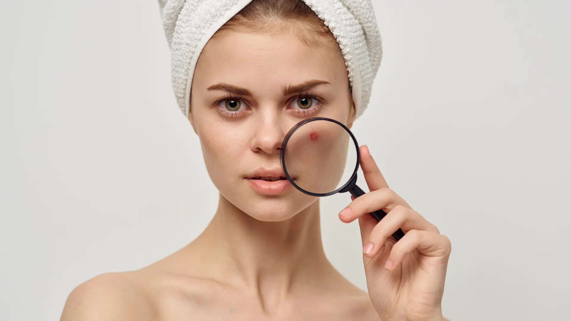 Importanța consultației dermatologice în tratamentul acneei